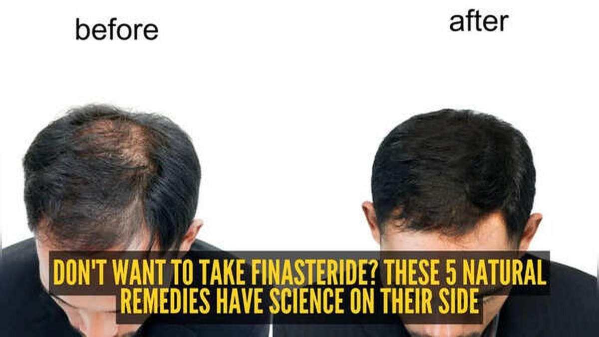Ways to Promote Hair Growth with Natural Remedies