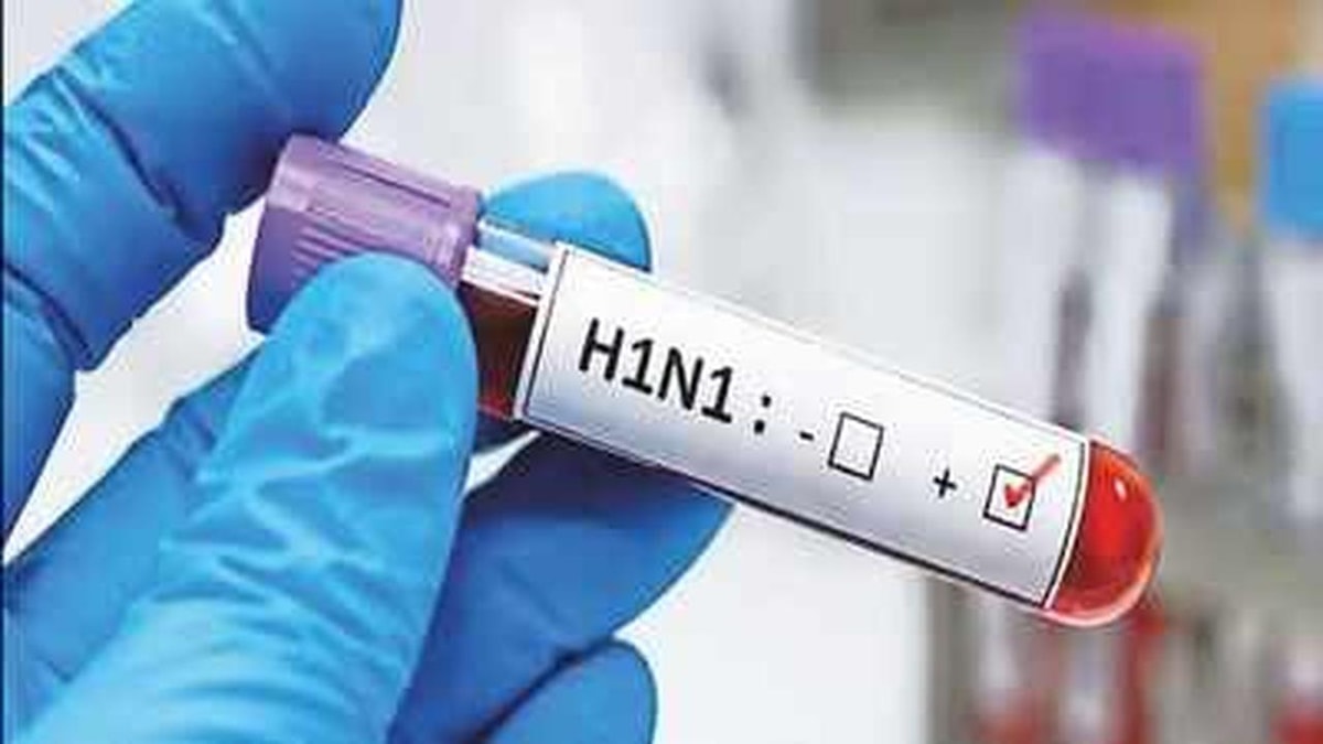 Delhi Sees Rise in H1N1 Cases Health Minister Says Situation Under Control Delhi Sees Rise in H1N1 Cases Health Minister Says Situation Under Control