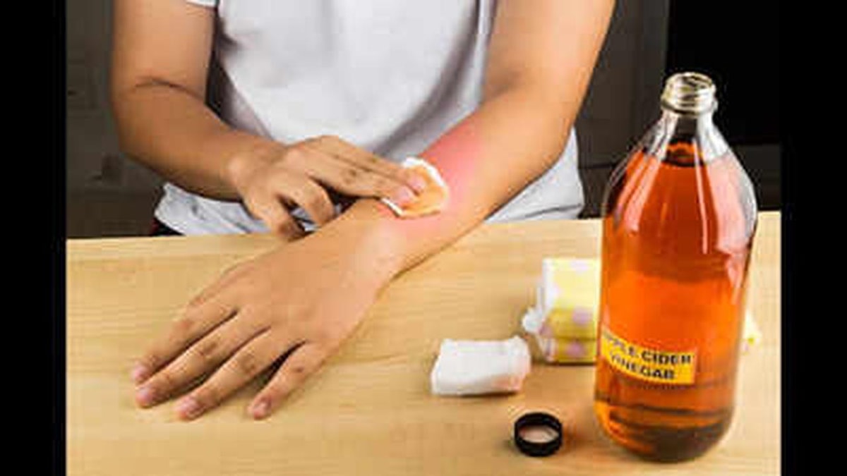 Removing Moles with Apple Cider Vinegar: Safe or Dangerous? Removing Moles with Apple Cider Vinegar: Safe or Dangerous?