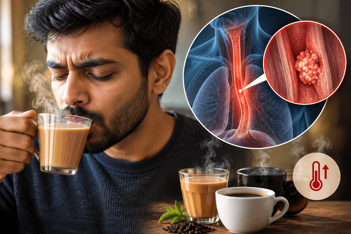 Hot Beverages Increase Esophageal Cancer Risk Hot Beverages Increase Esophageal Cancer Risk