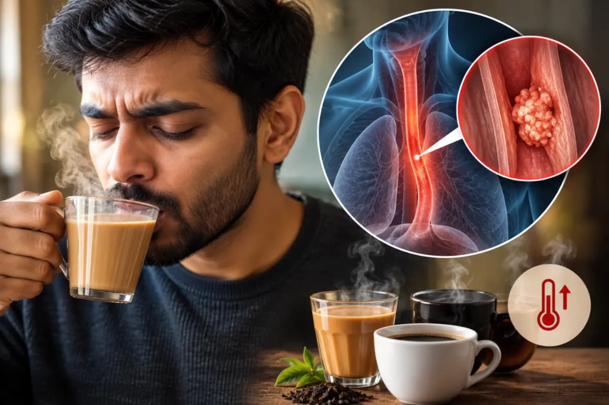 Hot Beverages Increase Esophageal Cancer Risk Hot Beverages Increase Esophageal Cancer Risk